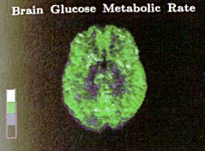 r_pg133.jpg (15422 bytes)