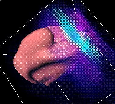 volimg1.jpg (36176 bytes)